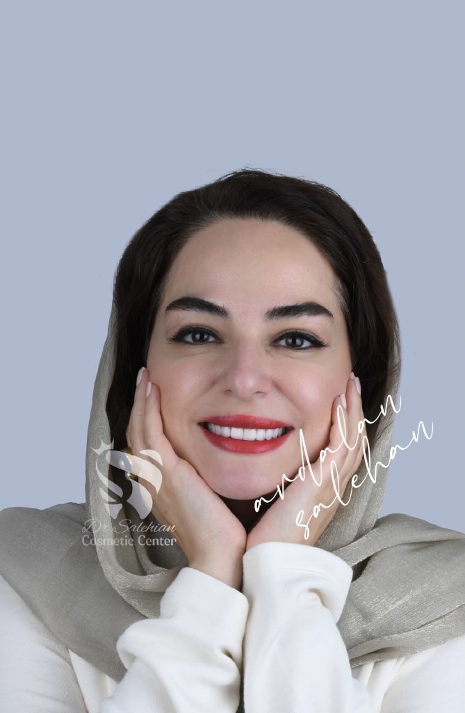 نمونه کار لمینت دندان
